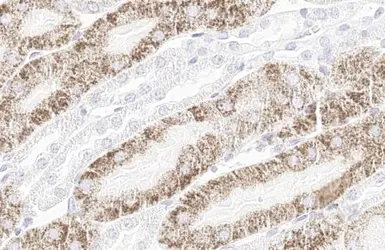 Anti-StAR antibody [HL1360] used in IHC (Paraffin sections) (IHC-P). GTX636800