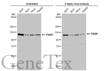 Anti-PARP antibody [HL1364] used in Western Blot (WB). GTX636804