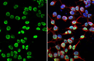 Anti-PARP antibody [HL1364] used in Immunocytochemistry/ Immunofluorescence (ICC/IF). GTX636804