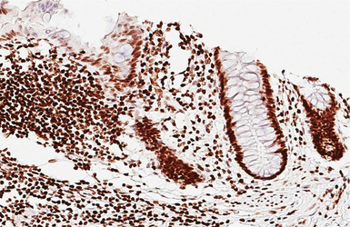 Anti-PARP antibody [HL1364] used in IHC (Paraffin sections) (IHC-P). GTX636804
