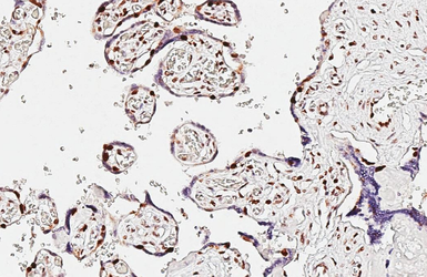 Anti-PARP antibody [HL1364] used in IHC (Paraffin sections) (IHC-P). GTX636804