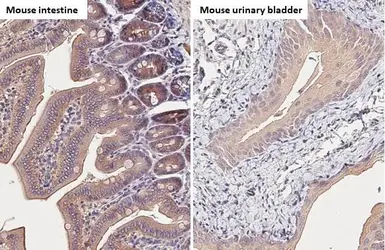 Anti-Carbonic Anhydrase IX antibody [HL1410] used in IHC (Paraffin sections) (IHC-P). GTX636876