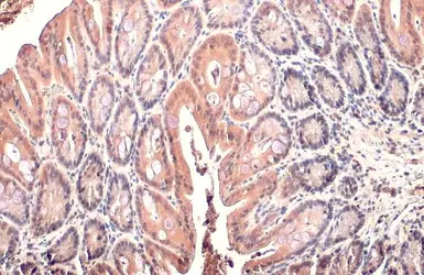 Anti-PI3 kinase p85 alpha antibody [HL1414] used in IHC (Paraffin sections) (IHC-P). GTX636880