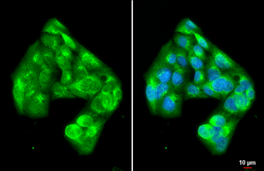 Anti-PI3 kinase p85 alpha antibody [HL1414] used in Immunocytochemistry/ Immunofluorescence (ICC/IF). GTX636880