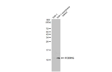 Anti-FCER1G antibody [HL1418] used in Western Blot (WB). GTX636884