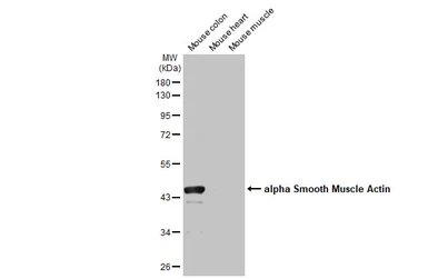 Anti-alpha Smooth Muscle Actin antibody [HL1419] used in Western Blot (WB). GTX636885