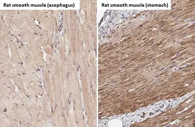 Anti-alpha Smooth Muscle Actin antibody [HL1419] used in IHC (Paraffin sections) (IHC-P). GTX636885