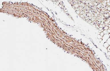 Anti-alpha Smooth Muscle Actin antibody [HL1419] used in IHC (Paraffin sections) (IHC-P). GTX636885