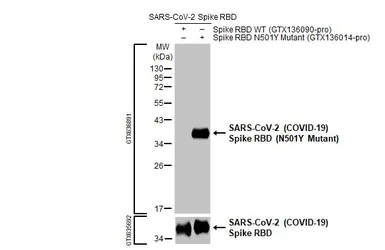 Anti-SARS-CoV-2 (COVID-19) Spike (N501Y Mutant) antibody [HL1425] used in Western Blot (WB). GTX636891