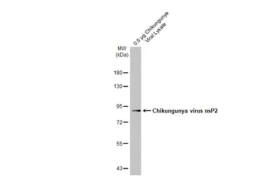 Anti-Chikungunya virus nsP2 antibody [HL1432] used in Western Blot (WB). GTX636898