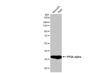 Anti-PP2A alpha antibody [HL1447] used in Western Blot (WB). GTX636919