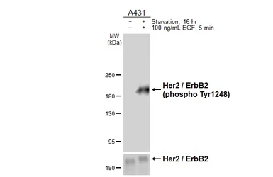 Anti-Her2 / ErbB2 (phospho Tyr1248) antibody [HL1466] used in Western Blot (WB). GTX636940