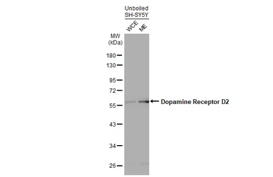 Anti-Dopamine Receptor D2 antibody [HL1478] used in Western Blot (WB). GTX636952