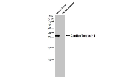 Anti-Cardiac Troponin I antibody [HL1489] used in Western Blot (WB). GTX636963