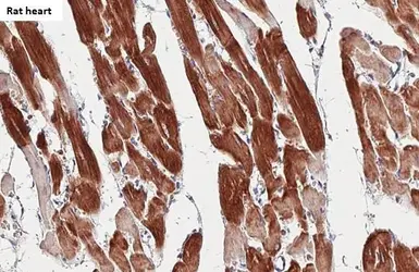 Anti-Cardiac Troponin I antibody [HL1489] used in IHC (Paraffin sections) (IHC-P). GTX636963