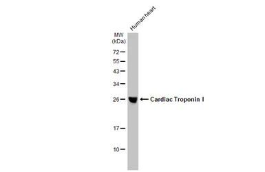 Anti-Cardiac Troponin I antibody [HL1489] used in Western Blot (WB). GTX636963