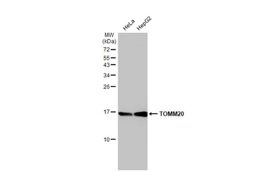 Anti-TOMM20 antibody [HL1493] used in Western Blot (WB). GTX636967