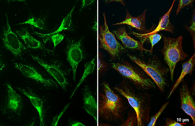 Anti-TOMM20 antibody [HL1493] used in Immunocytochemistry/ Immunofluorescence (ICC/IF). GTX636967