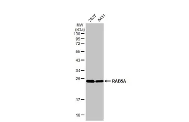 Anti-RAB5A antibody [HL1497] used in Western Blot (WB). GTX636971