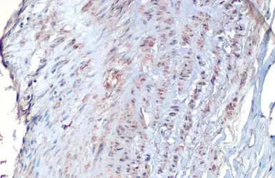 Anti-Vimentin antibody [HL1506] used in IHC (Paraffin sections) (IHC-P). GTX636980