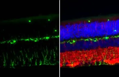 Anti-Vimentin antibody [HL1506] used in IHC (Paraffin sections) (IHC-P). GTX636980