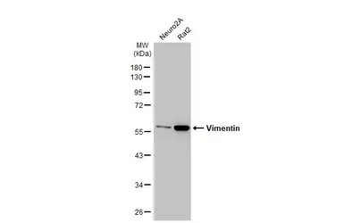 Anti-Vimentin antibody [HL1506] used in Western Blot (WB). GTX636980