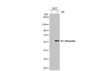 Anti-Vimentin antibody [HL1506] used in Western Blot (WB). GTX636980