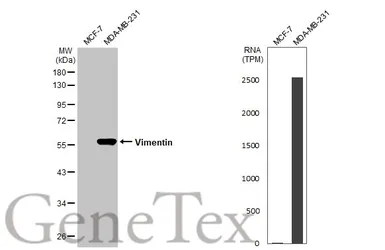Anti-Vimentin antibody [HL1506] used in Western Blot (WB). GTX636980