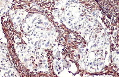 Anti-Vimentin antibody [HL1506] used in IHC (Paraffin sections) (IHC-P). GTX636980