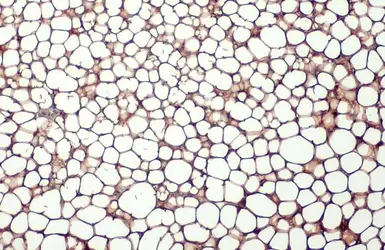 Anti-FABP4 antibody [HL1520] used in IHC (Paraffin sections) (IHC-P). GTX636994