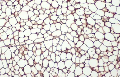 Anti-FABP4 antibody [HL1521] used in IHC (Paraffin sections) (IHC-P). GTX636995