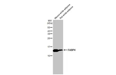 Anti-FABP4 antibody [HL1521] used in Western Blot (WB). GTX636995