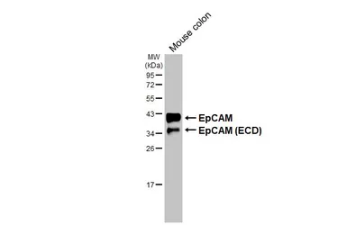 Anti-EpCAM antibody [HL1524] used in Western Blot (WB). GTX636998