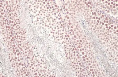 Anti-U2AF65 antibody [HL1583] used in IHC (Paraffin sections) (IHC-P). GTX637062