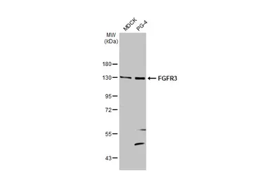 Anti-FGFR3 antibody [HL1595] used in Western Blot (WB). GTX637074
