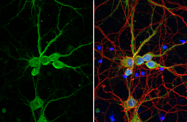 Anti-delta 2 Catenin antibody  [HL1629] used in Immunocytochemistry/ Immunofluorescence (ICC/IF). GTX637122