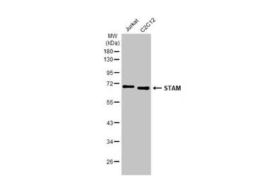 Anti-STAM antibody [HL1637] used in Western Blot (WB). GTX637130
