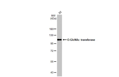 Anti-O-GlcNAc transferase antibody [HL1642] used in Western Blot (WB). GTX637223
