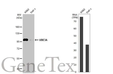 Anti-UBE3A antibody [HL1660] used in Western Blot (WB). GTX637258