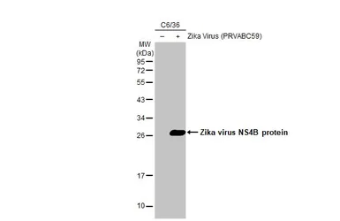 Anti-Zika virus NS4B protein antibody [HL1664] used in Western Blot (WB). GTX637262