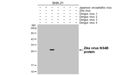 Anti-Zika virus NS4B protein antibody [HL1664] used in Western Blot (WB). GTX637262