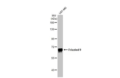 Anti-Frizzled 9 antibody [HL1675] used in Western Blot (WB). GTX637274
