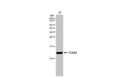 Anti-TCEB1 antibody [HL1683] used in Western Blot (WB). GTX637282