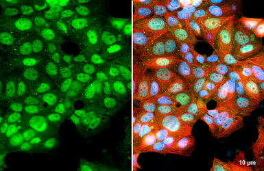 Anti-KDM6A antibody [HL1731] used in Immunocytochemistry/ Immunofluorescence (ICC/IF). GTX637379