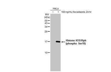 Anti-Histone H3S10ph (phospho Ser10) antibody [HL1752] used in Western Blot (WB). GTX637402