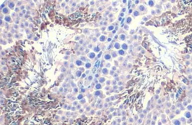 Anti-PGK1 + PGK2 antibody [HL1775] used in IHC (Paraffin sections) (IHC-P). GTX637427