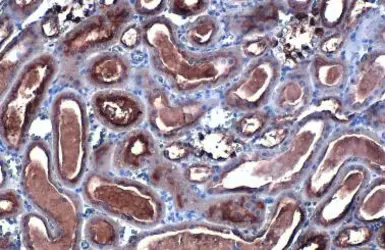 Anti-CYP27A1 antibody [HL1819] used in IHC (Paraffin sections) (IHC-P). GTX637544