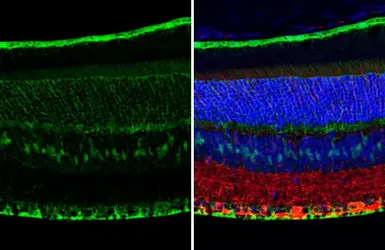 Anti-CRALBP antibody [HL1833] used in IHC (Paraffin sections) (IHC-P). GTX637558