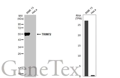 Anti-TRIM72 antibody [HL1853] used in Western Blot (WB). GTX637578