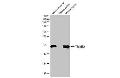 Anti-TRIM72 antibody [HL1853] used in Western Blot (WB). GTX637578